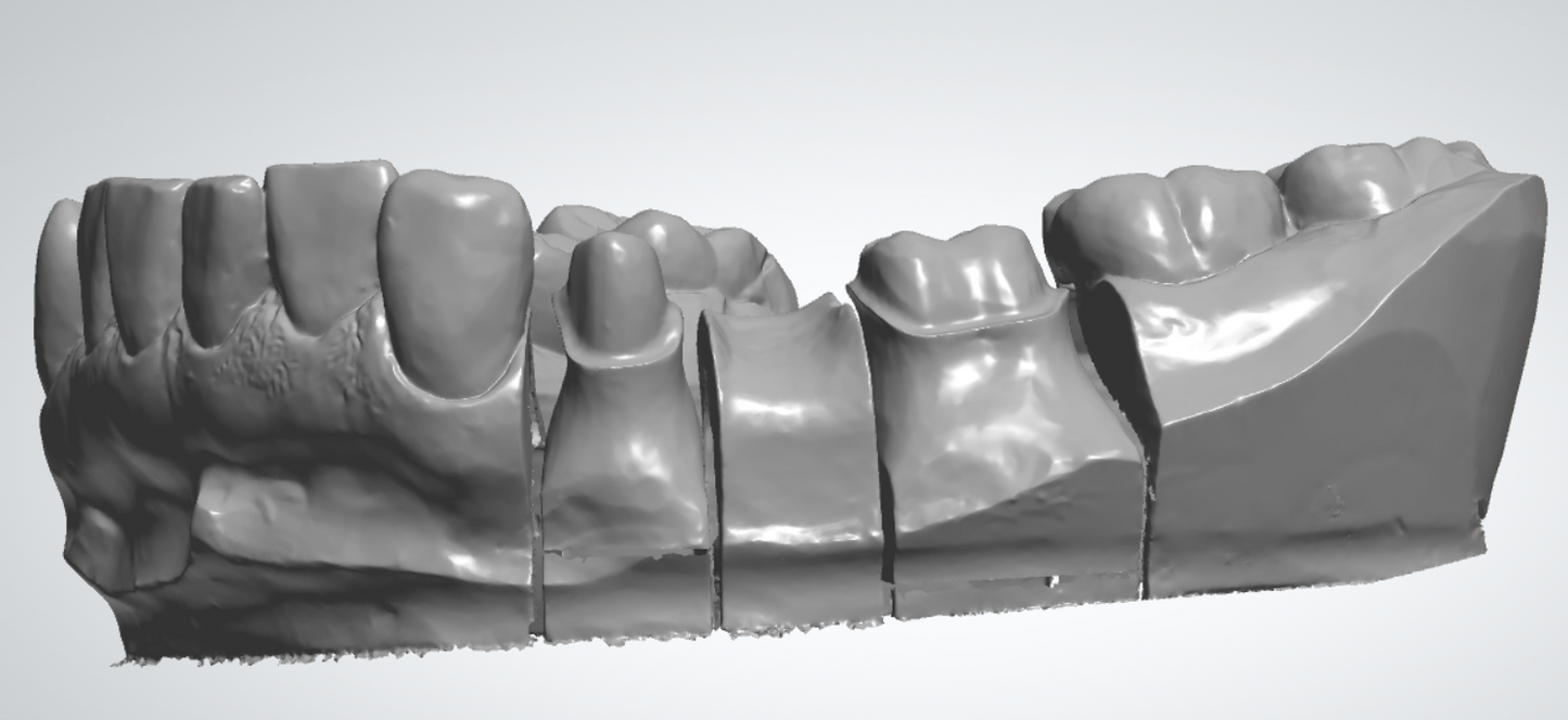 Digital Dentistry 3D Model Scan DeskElf