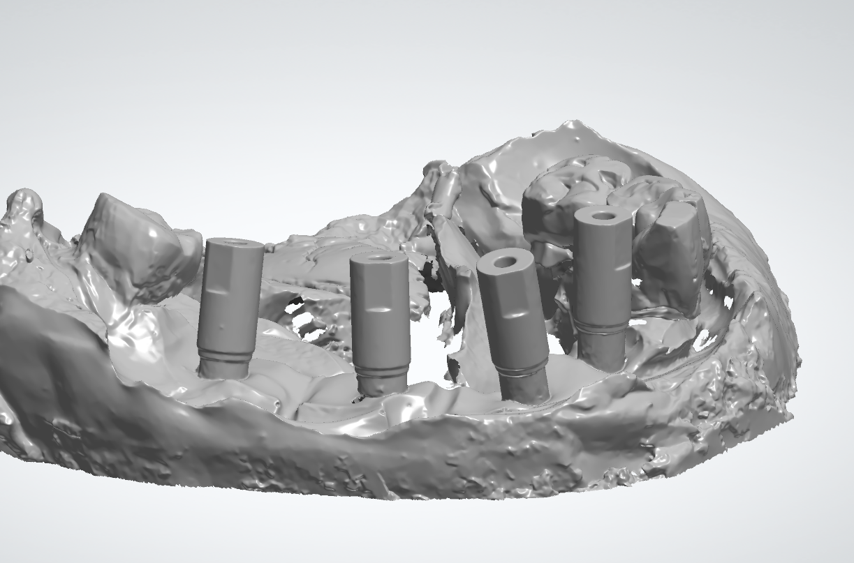 Digital Dentistry 3D Model Scan DeskElf